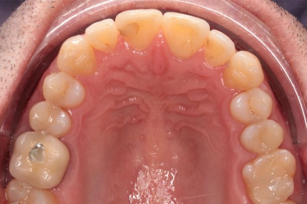 Ortodoncia - Después