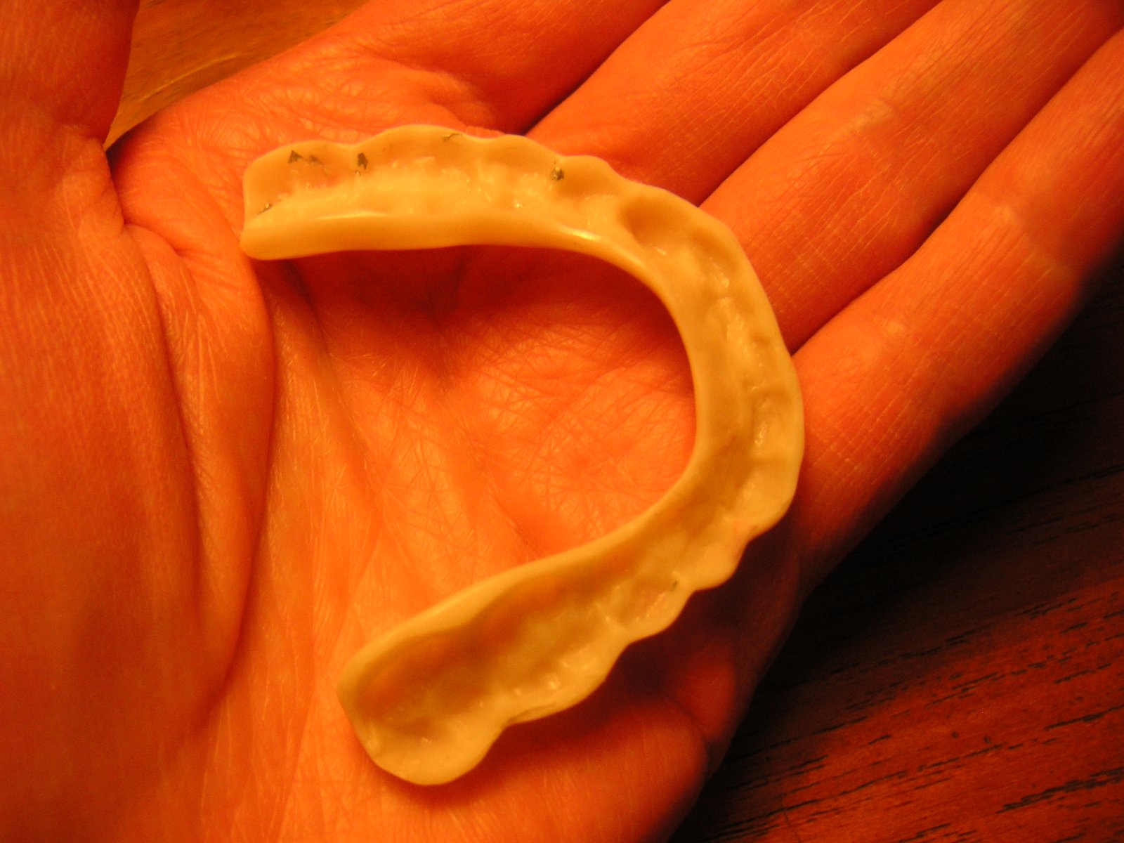 Hard splint mouthguard (4203068291)