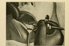 This image is taken from the surgery of oral diseases and malformations, their diagnosis and treatment