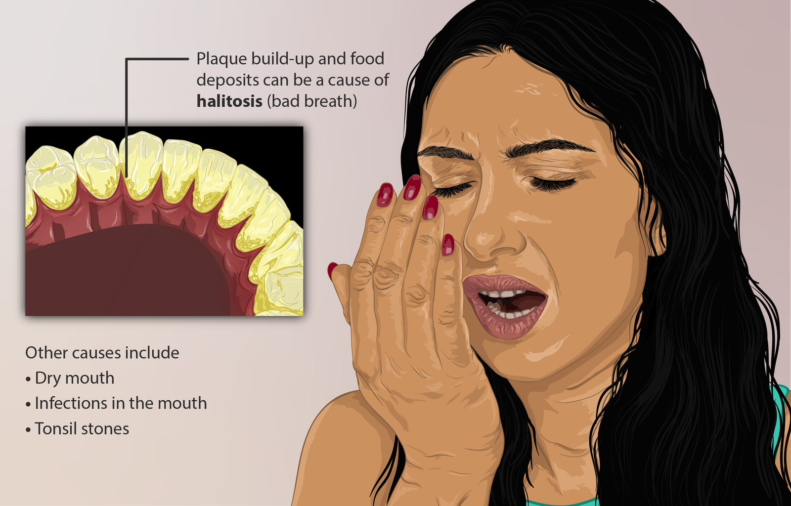 Depiction of a person who has halitosis (or bad breath)