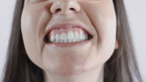 Paciente observando dientes asperos